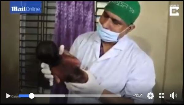 Retour à la case départ : une femme donne naissance à un « bébé singe » (vidéo)