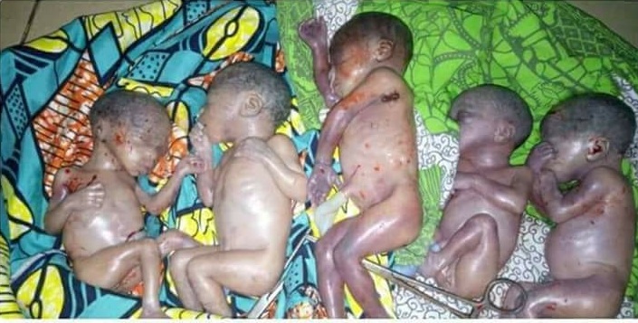 Une femme met au monde 5 bébés après plus d’une décennie de stérilité