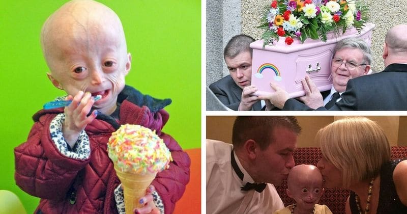 Cette enfant vieillit dix fois plus vite que n’importe qu’elle autre humain et décède à 8 ans