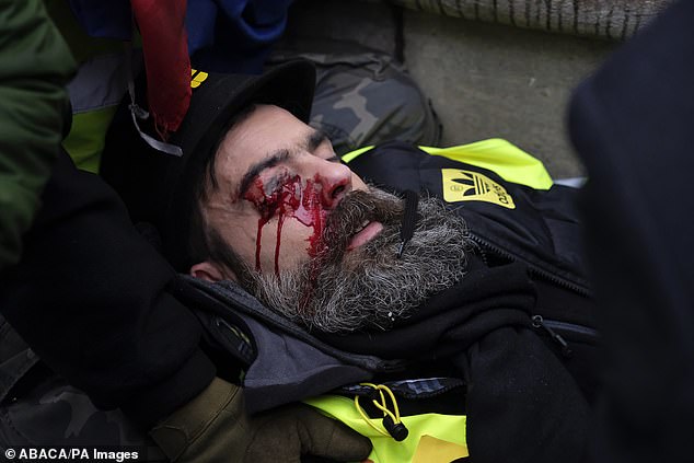 Le chef de la manifestation, gilet jaune, est plongé dans le coma après avoir été touché par un projectile de la police lors d&rsquo;une attaque