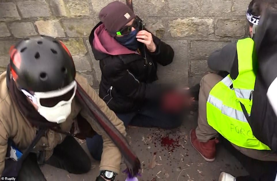 La main d&rsquo;un gilet jaune déchirée dans de terribles scènes de violence entre la police et des manifestants à Paris