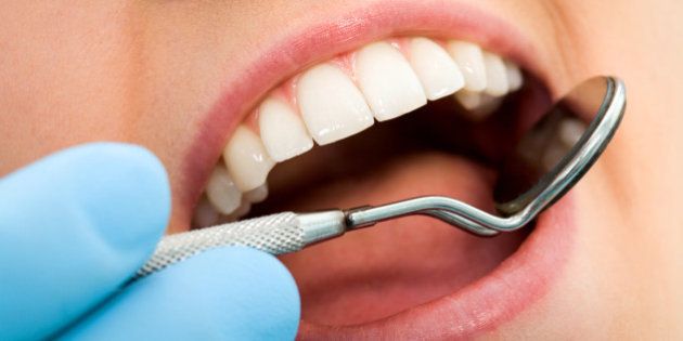 7 choses que votre bouche peut révéler sur votre santé