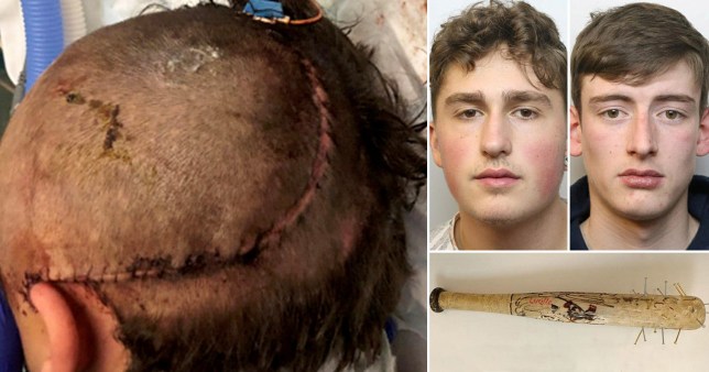 Un adolescent a laissé un garçon de 16 ans handicapé après l&rsquo;avoir attaqué avec une batte de baseball de style Walking Dead