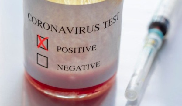 Plus d&rsquo;un demi-million de personnes infectées par le coronavirus dans le monde et plus de 15 000 personnes sont décédées rien qu&rsquo;en Europe