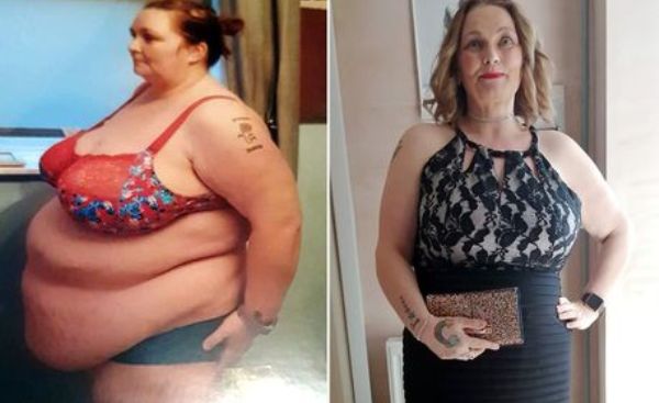 Une femme subit une transformation étonnante après qu&rsquo;un médecin l&rsquo;a avertie qu&rsquo;elle devait « suivre un régime ou mourir »